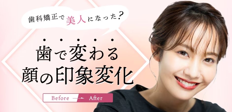 歯科矯正で顔の印象が変わる？美人と評判のビフォーアフターイメージ