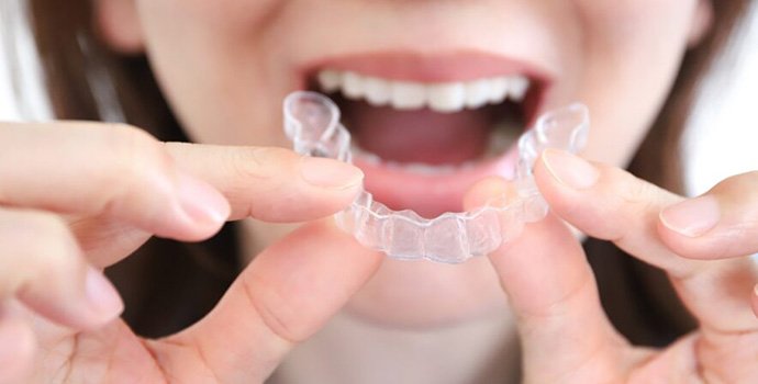 透明で目立たないマウスピース矯正（インビザライン）を装着しようとする女性の口元