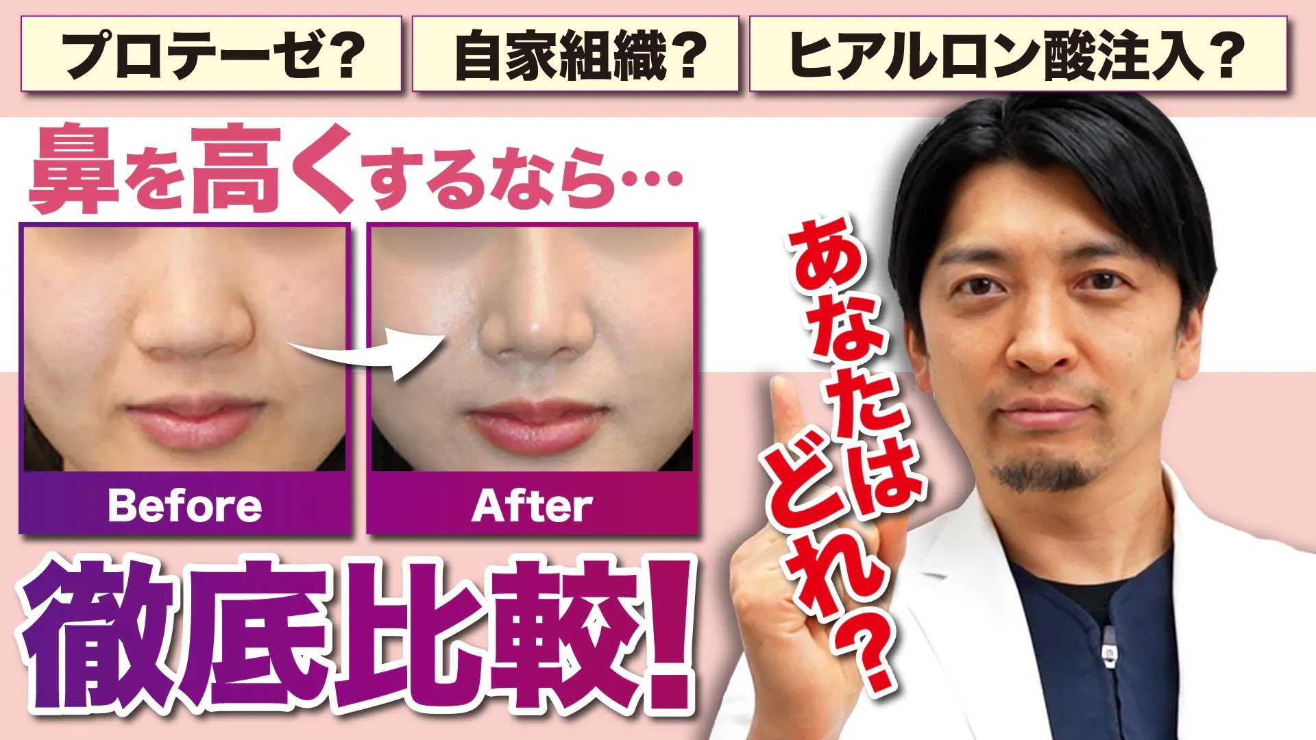 鼻を高くする施術（プロテーゼ・自家組織・ヒアルロン酸）の徹底比較とビフォーアフター