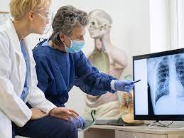 肺のレントゲン検査画像を見て肺がんの影や進行度を診断する医師